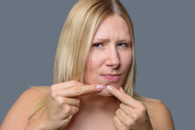 Kako se najbrže rešiti mitisera?